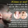 Rinoplastia Natural - Imagen 4