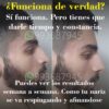 Rinoplastia Natural - Imagen 5